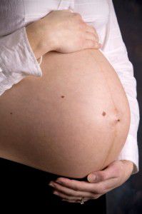 113607016 Linea nigra 199x300 Hyperpigmentation in pregnancy: Darkening of freckles, scars, nipples, genitals, thighs and arm pits
