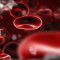 Rise in maternal sepsis-related mortality