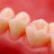 Men with erection problems are three times more likely to have inflamed gums