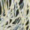 Electrically spun fabric offers dual defense against pregnancy, HIV