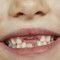 Obese kids have less sensitive taste-buds