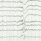 A trigger for epileptic seizures