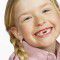 Pit and fissure sealants: How they prevent cavities in children’s teeth