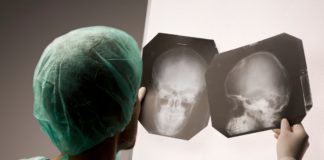 Cranial x-ray