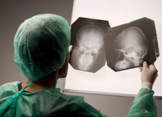 Cranial x-ray