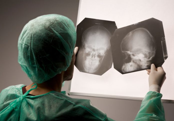 Cranial x-ray