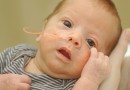 Premature baby boy with a hand cradling his head