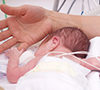 preterm-baby-hospital-incubator-100×100