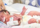 Newborn premature baby in the NICU intensive care