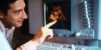 Doctor looking at ultrasound