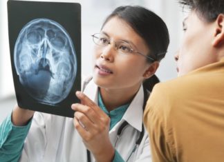 Doctor examining head x-ray