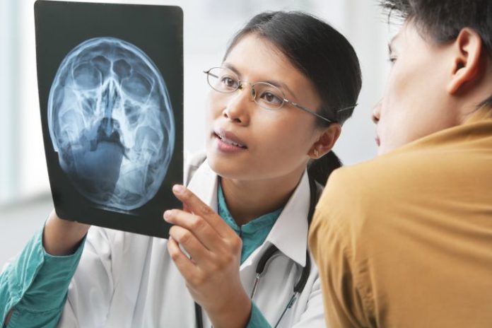 Doctor examining head x-ray