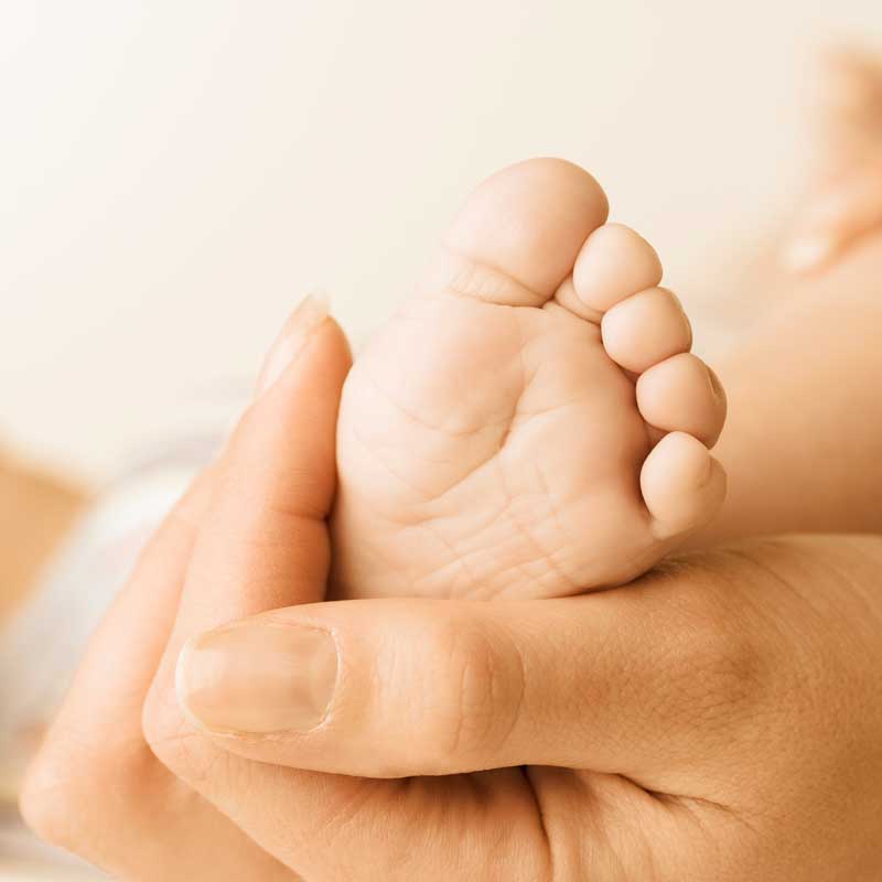 Clubfoot: a mother's story