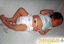 baby-umbilical-cord