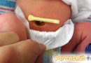 baby-umbilical-cord2