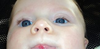 A snapshot of a baby with a red spot on its tongue.