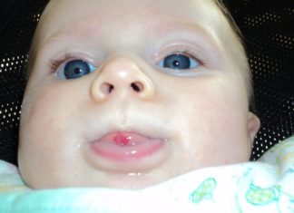 A snapshot of a baby with a red spot on its tongue.