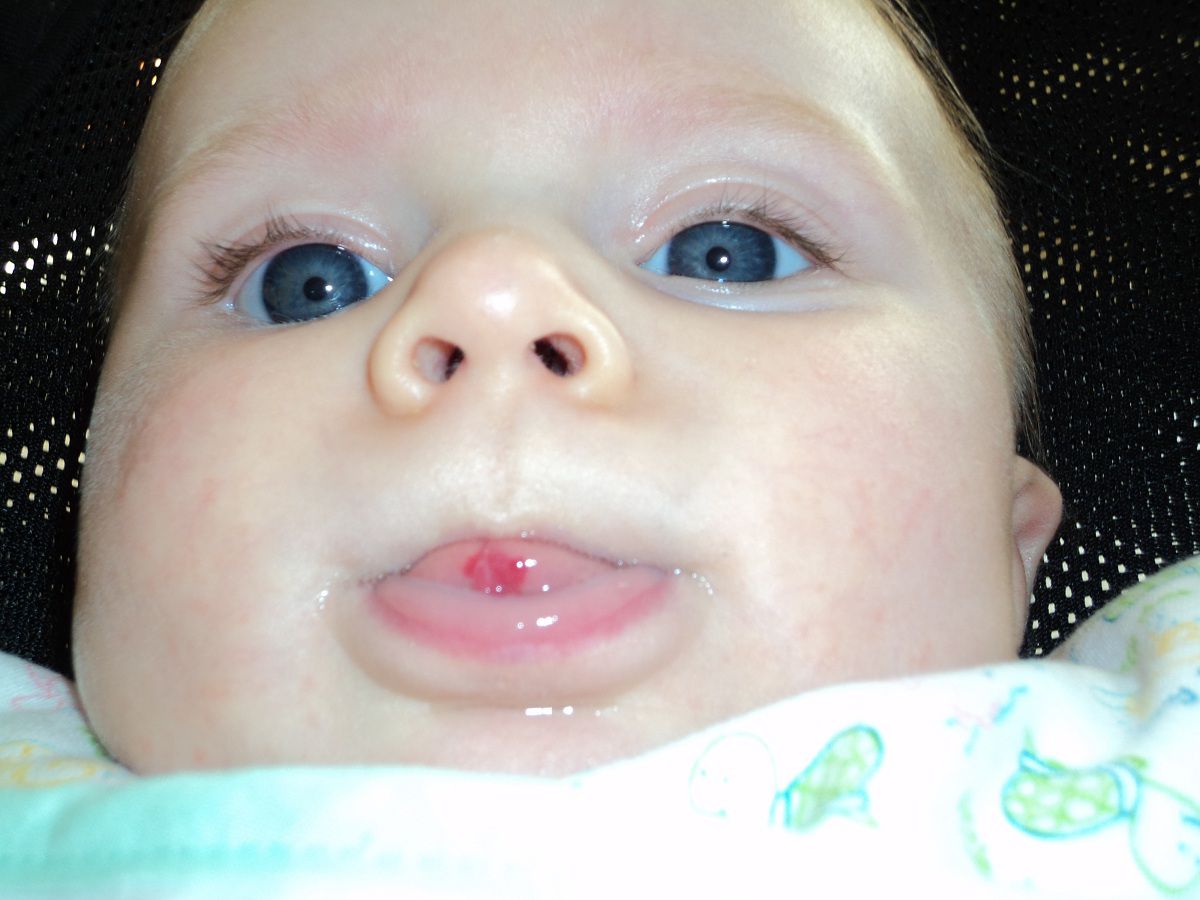 A snapshot of a baby with a red spot on its tongue.